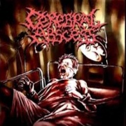 CEREBRAL ABSCESS 